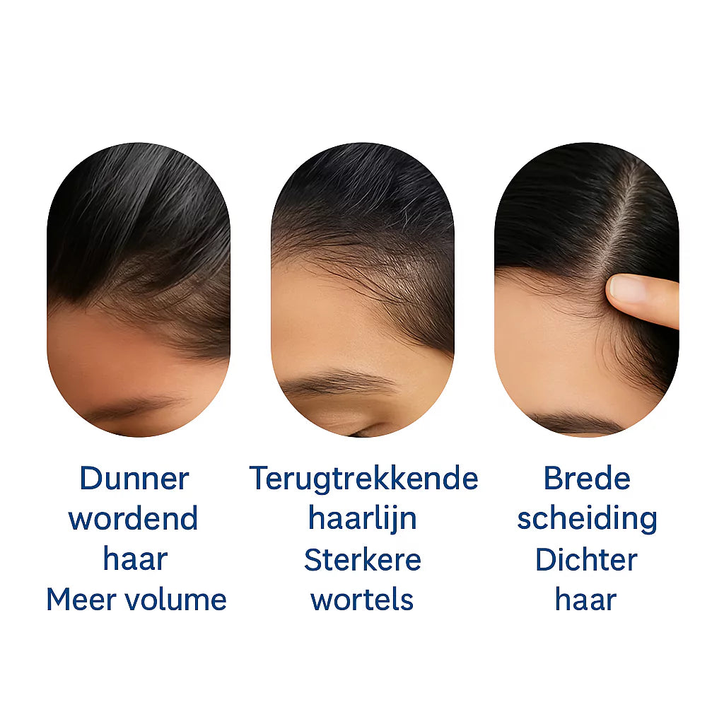 Bodywise Haargroei Roller (25ml)